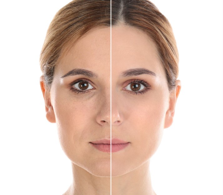 عکس مرتبط با محصول